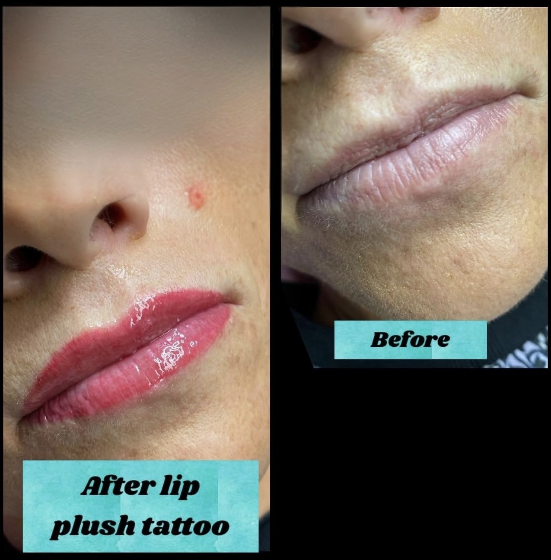 💋 Lip Blush Treatment transformation 2